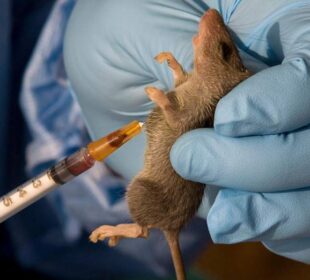 Lassa fever